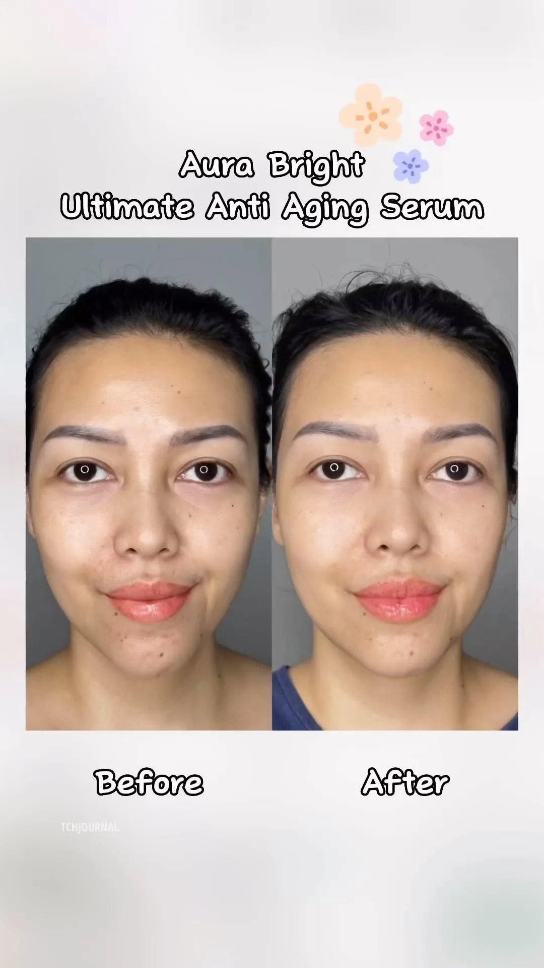 Anti Aging Serum Skinvestment