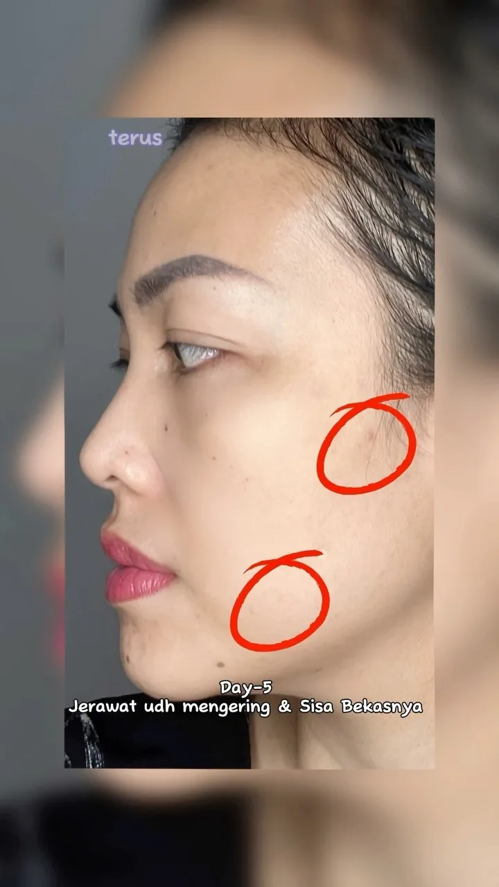 All in One untuk skin barrier yang lebih sehat