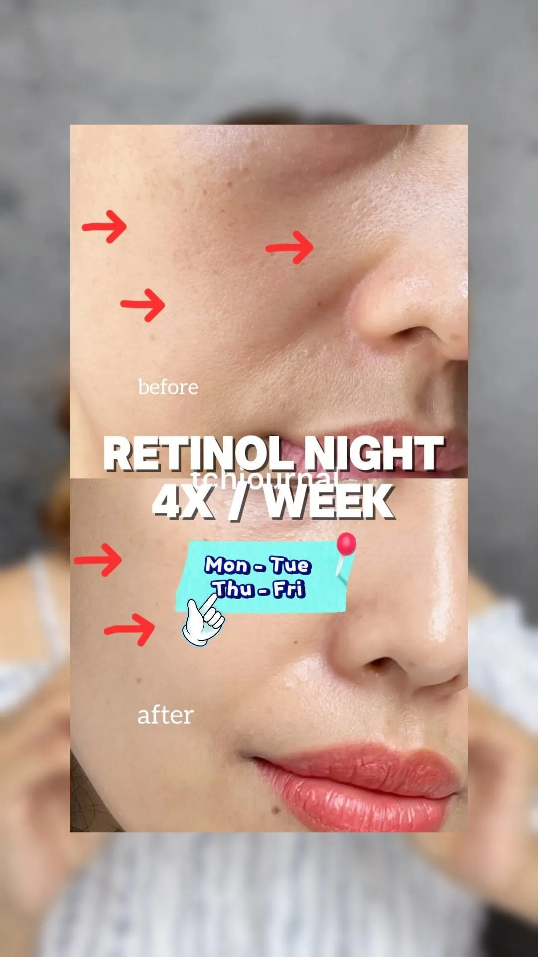 Retinol Night — 4x Seminggu