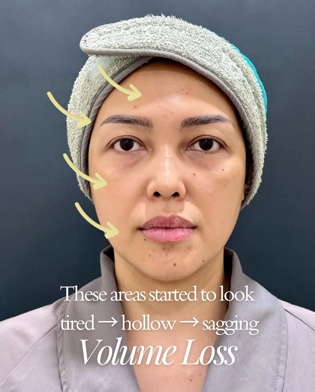 Part-2 — Aging is natural… but feeling beautiful is a choice we’re… — 3/9