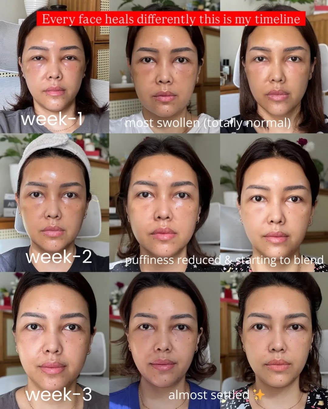 Part-2 — Aging is natural… but feeling beautiful is a choice we’re… — 5/9