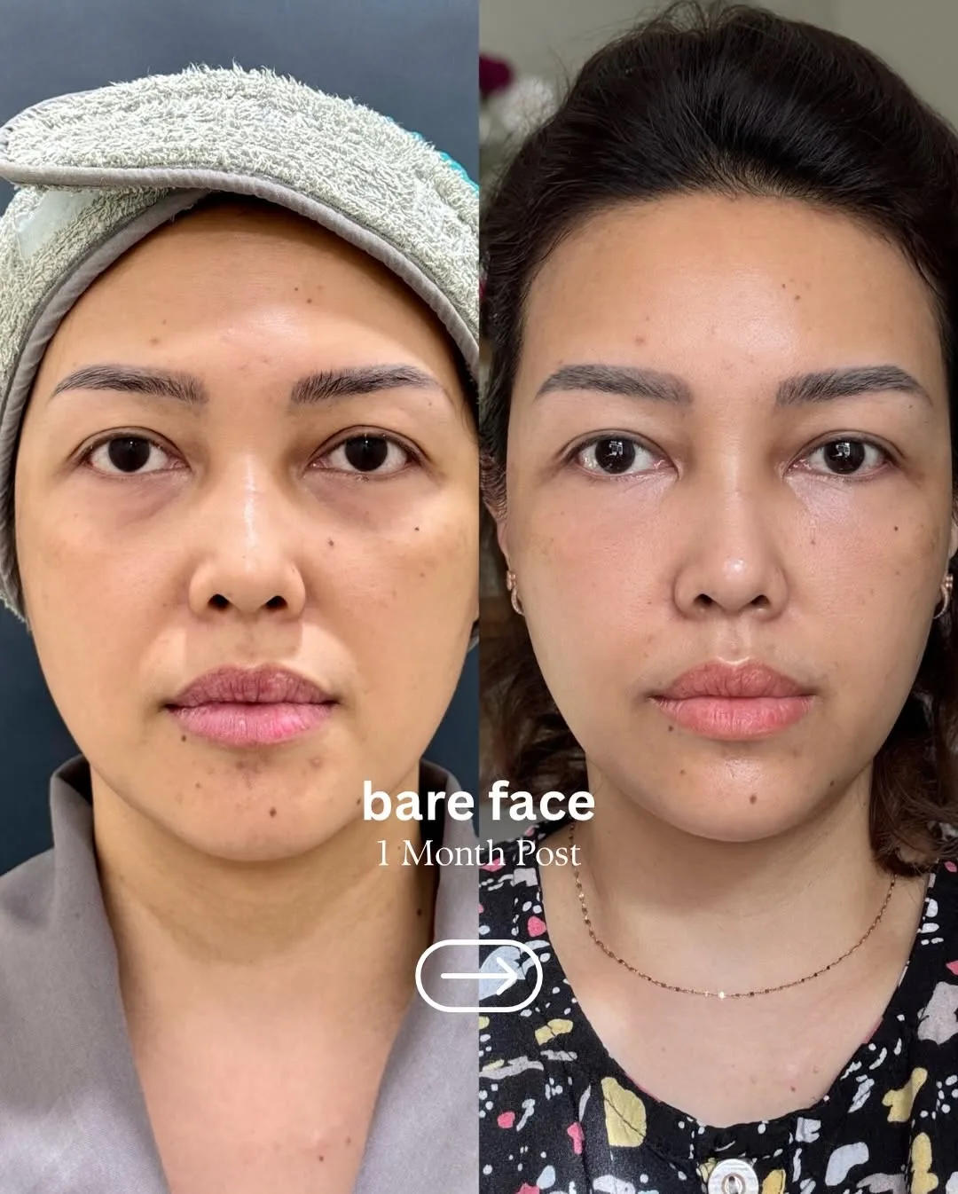 Part-2 — Aging is natural… but feeling beautiful is a choice we’re… — 6/9
