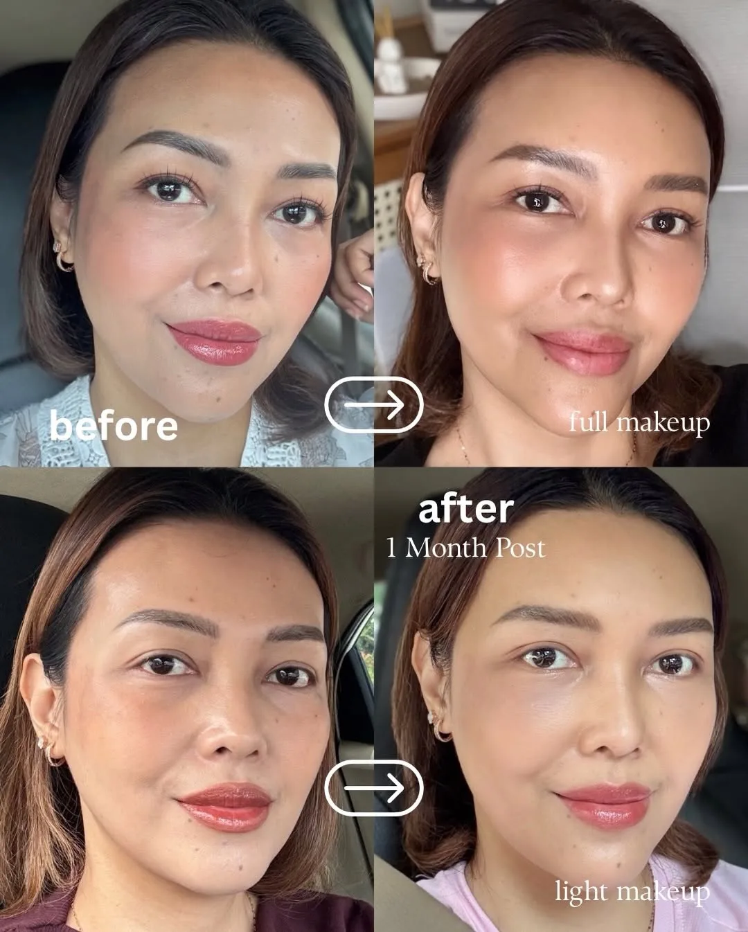 Part-2 — Aging is natural… but feeling beautiful is a choice we’re… — 7/9