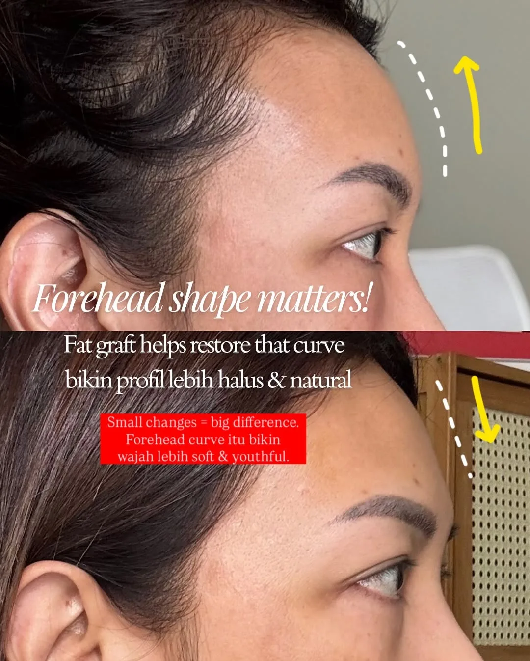 Part-2 — Aging is natural… but feeling beautiful is a choice we’re… — 8/9