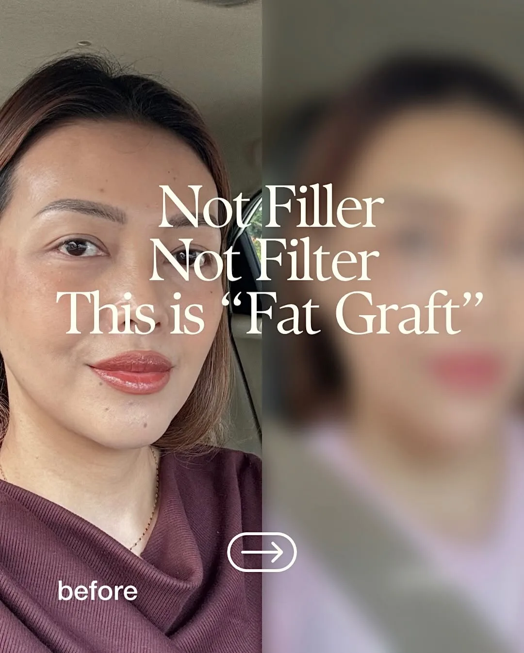 Part-2 — Aging is natural… but feeling beautiful is a choice we’re…