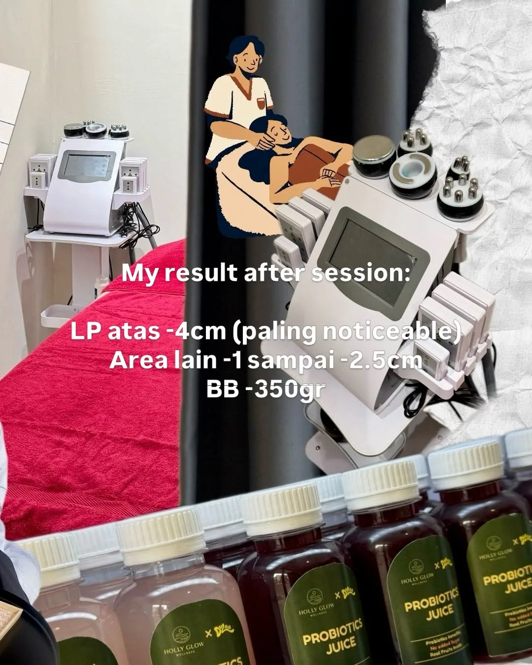 First time coba lymphatic massage di Holly Glow Express, dan ternyata… — 5/6