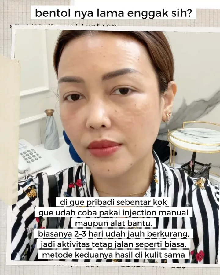 Skin diary — 3 bulan terakhir gue lagi rutin HP Vitaran, treatment… — 3/4