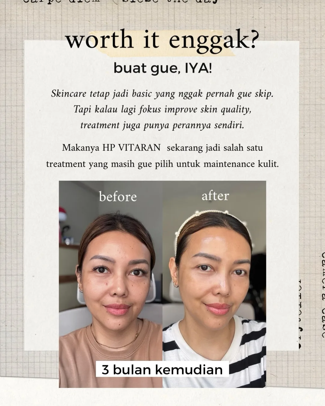 Skin diary — 3 bulan terakhir gue lagi rutin HP Vitaran, treatment… — 4/4