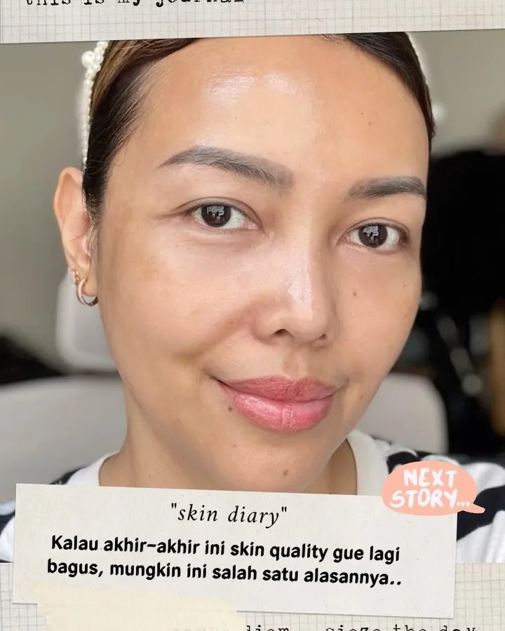 Skin diary — 3 bulan terakhir gue lagi rutin HP Vitaran, treatment…