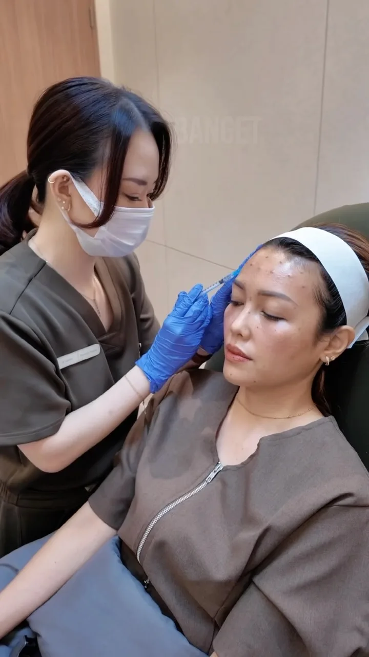 Ternyata yang gue butuhin namanya botox brow lift, botox yang bikin…